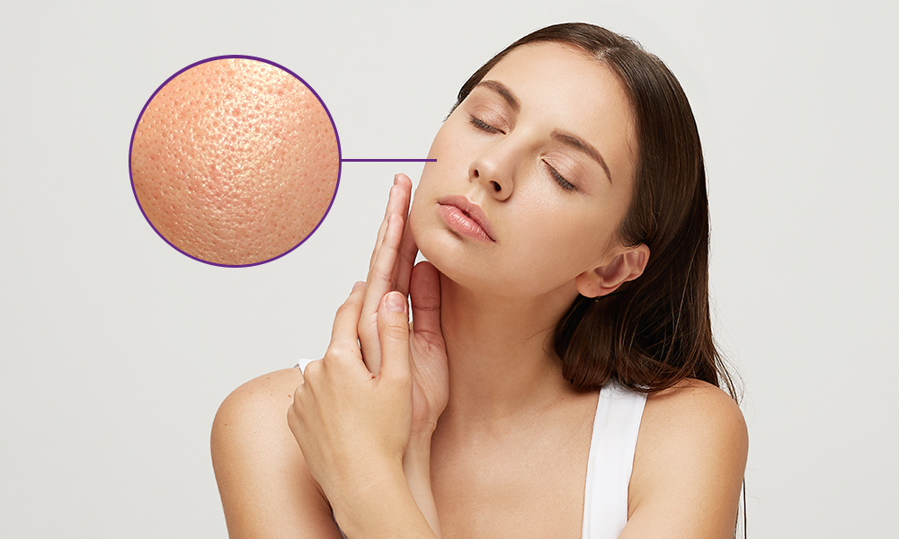 Как сделать расширенные поры на лице менее заметными