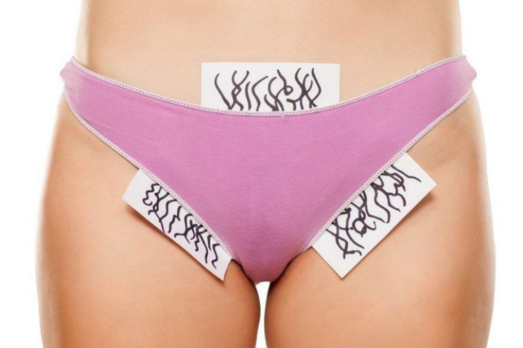 Как избавиться от вросших волос после шугаринга