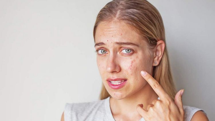 Аллергия на косметику: как проявляется и что с этим делать