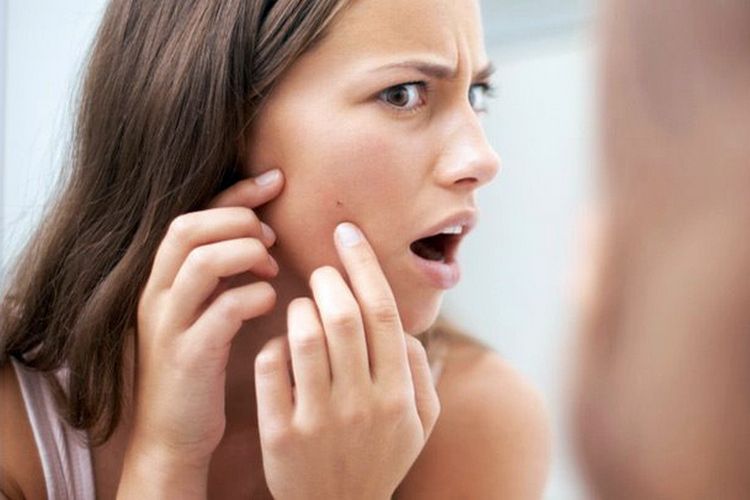 Не стоит самостоятельно выдавливать прыщи. Это чревато появлением рубцов 